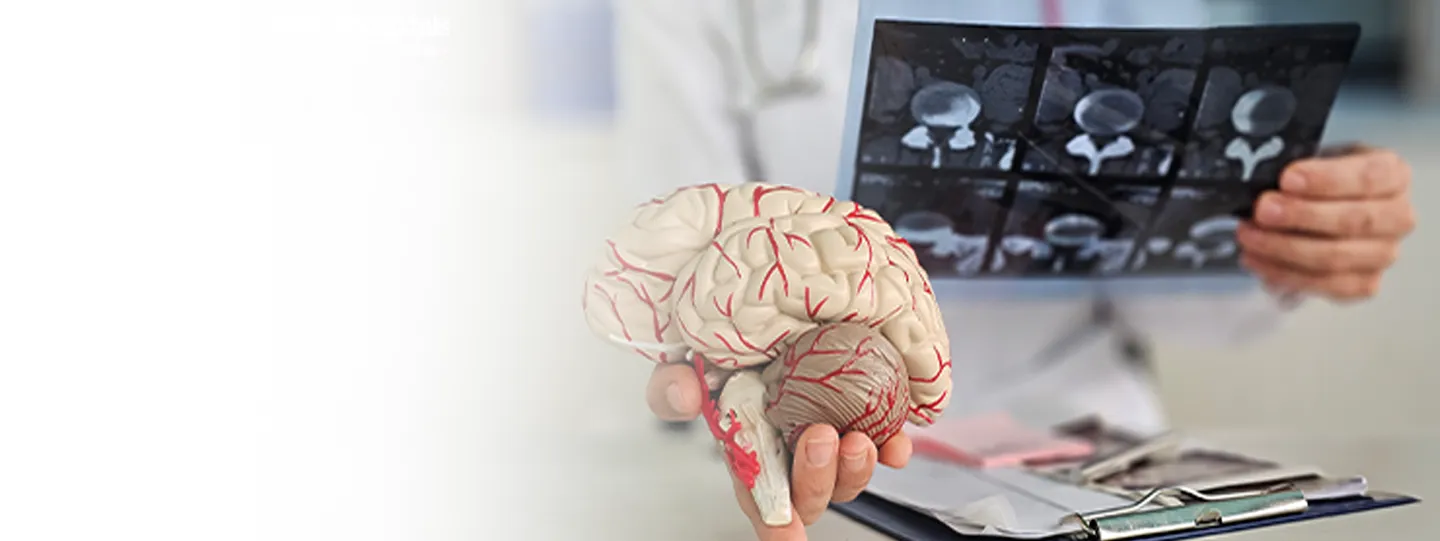 Brain Stroke Explained: Early Symptoms, Causes, and How You Can Take Action